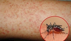 Cảnh báo gia tăng dịch bệnh sốt xuất huyết